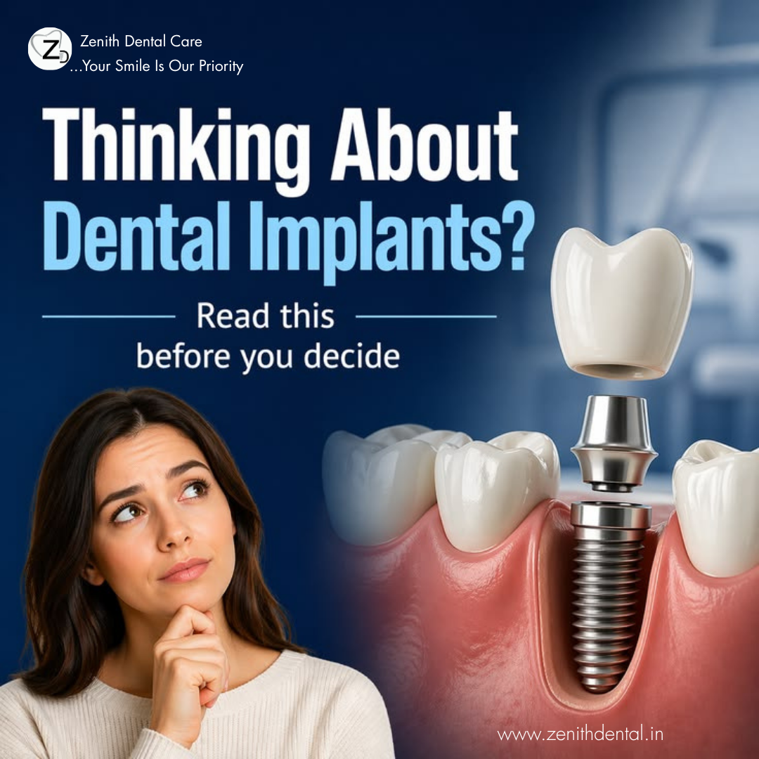 Are Dental Implants Painful? Process, Recovery| Noida