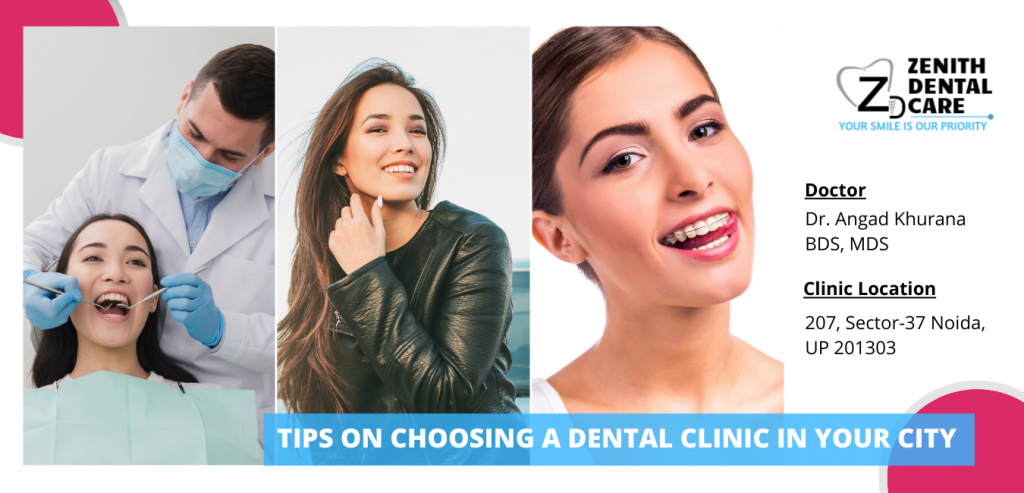 Best Dental Clinic In Noida
