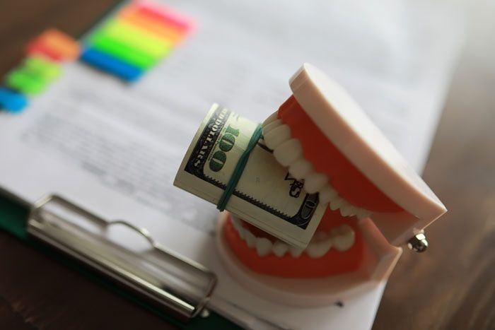 How Much Does Root Canal Treatment Cost in Noida?