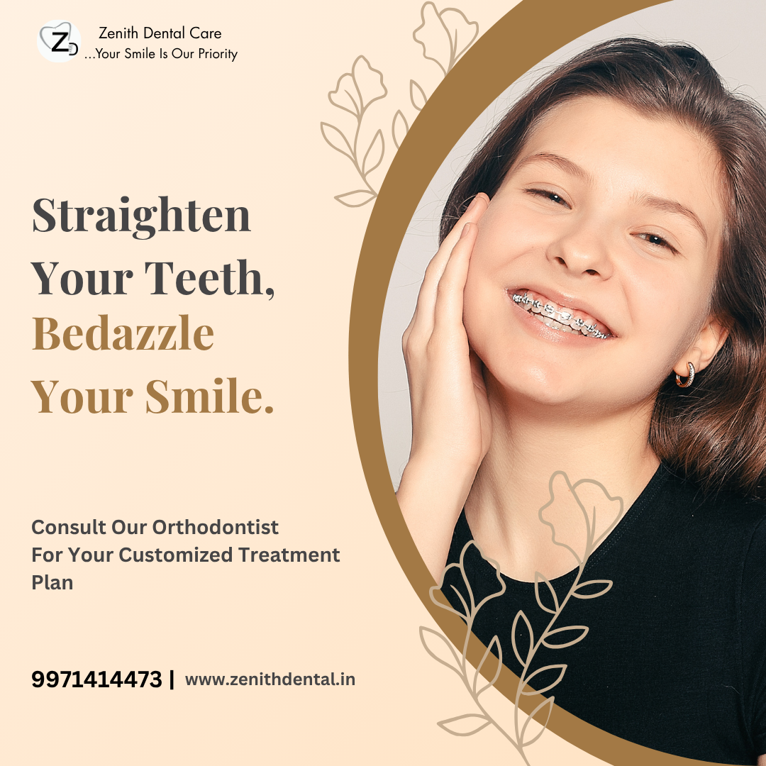 Orthodontic Treatment In Noida: Types, Cost & Duration