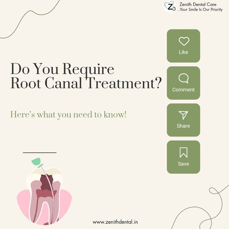 Root Canal Treatment â€“ Symptoms & When You Need RCT