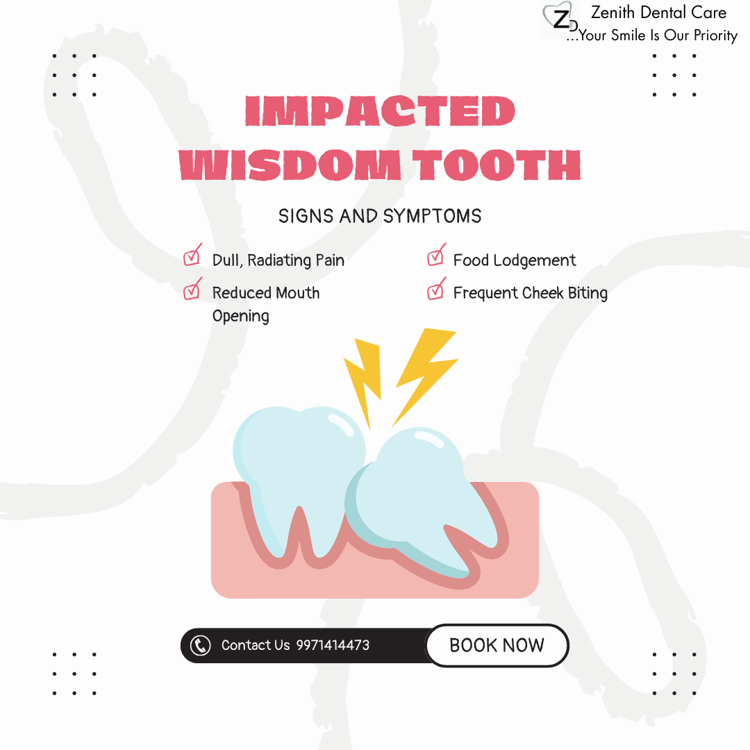 Wisdom Tooth Removal Cost in Zenith Dental Care, Noida