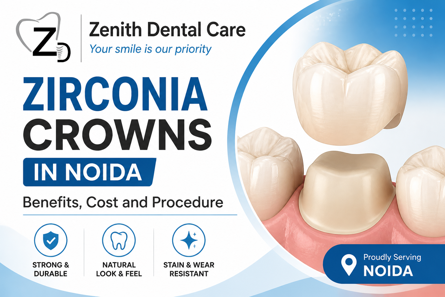 Zirconia Crowns in Noida: Benefits, Cost and Procedure