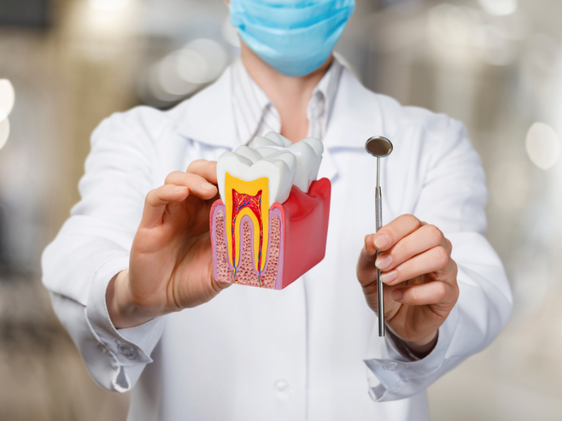 Root Canal Treatment Slide