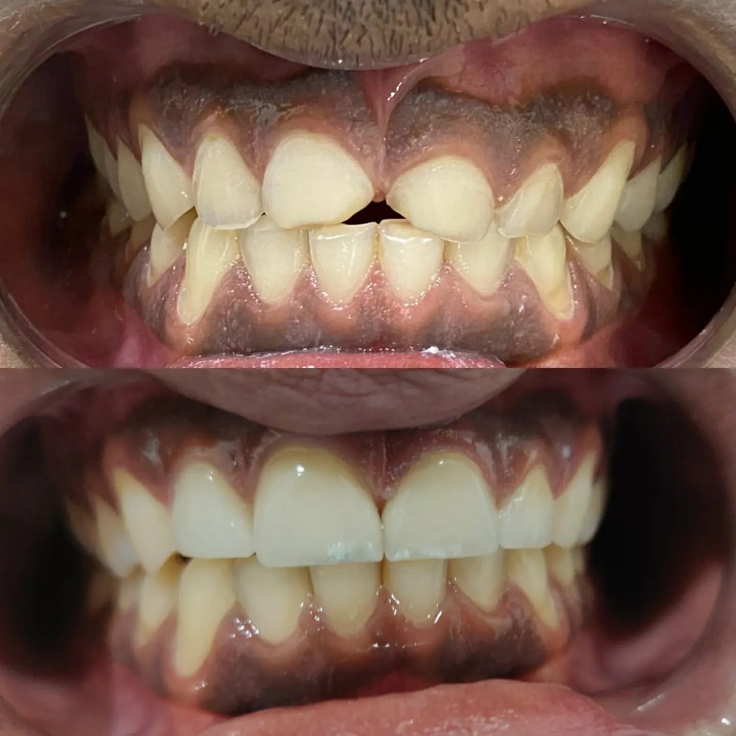 Cosmetic Dentistry Slide
