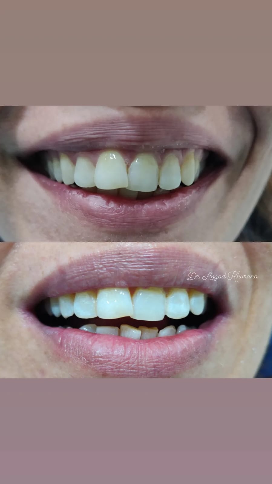 Cosmetic Dentistry Slide