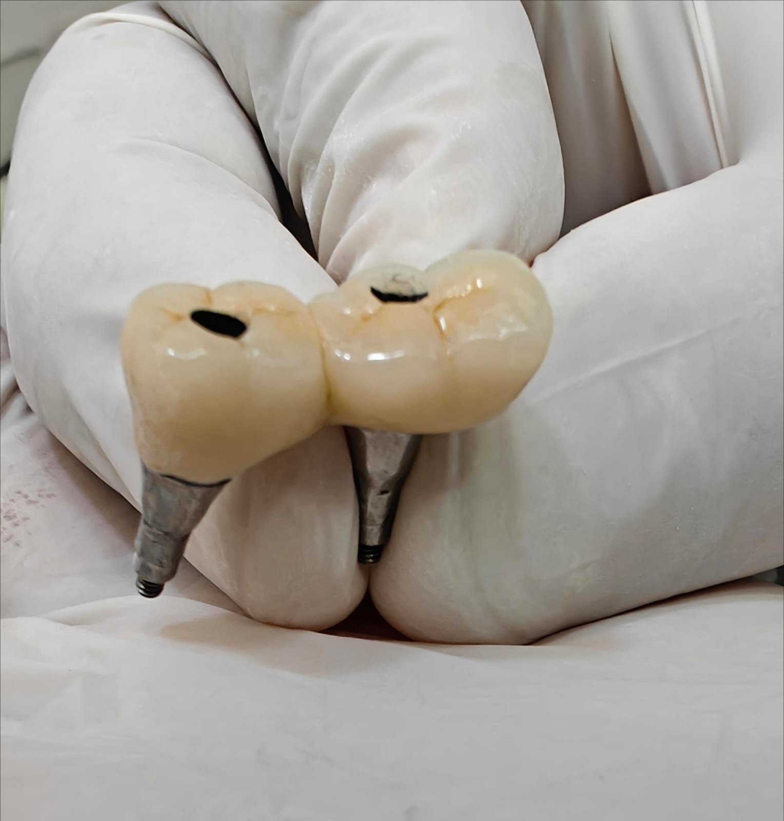 Dental Implants Slide