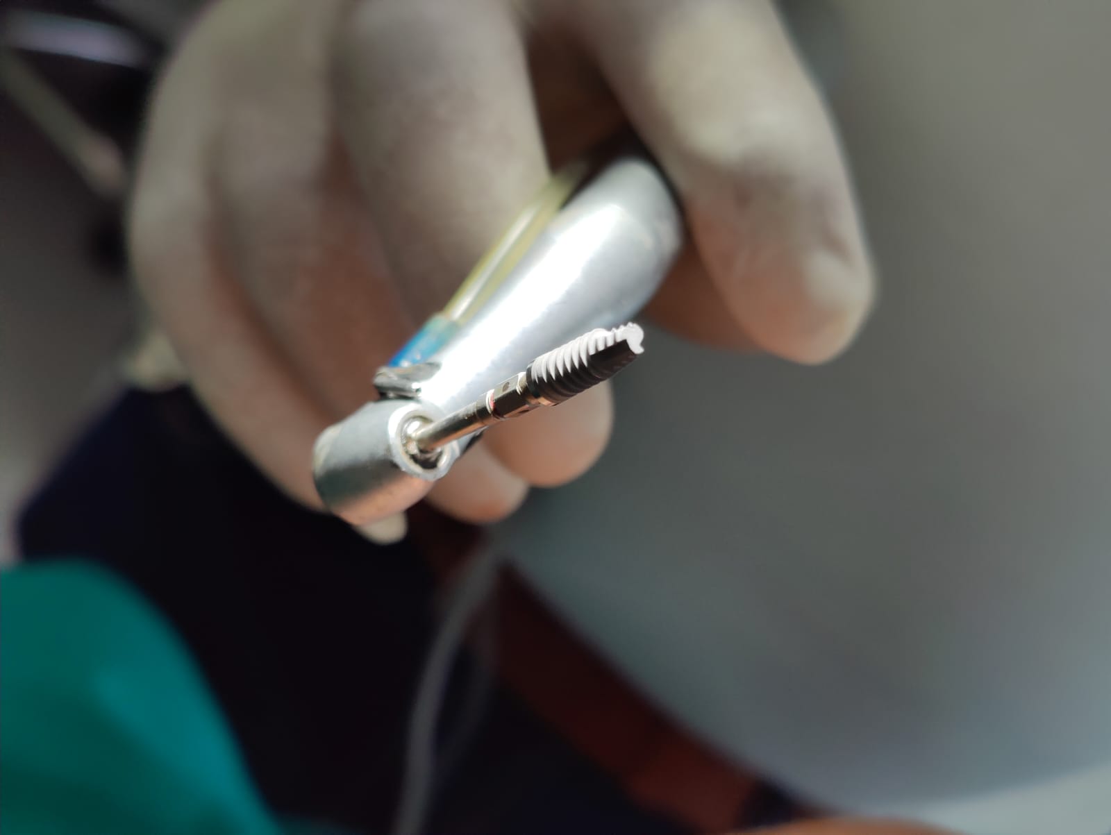 Dental Implants Slide