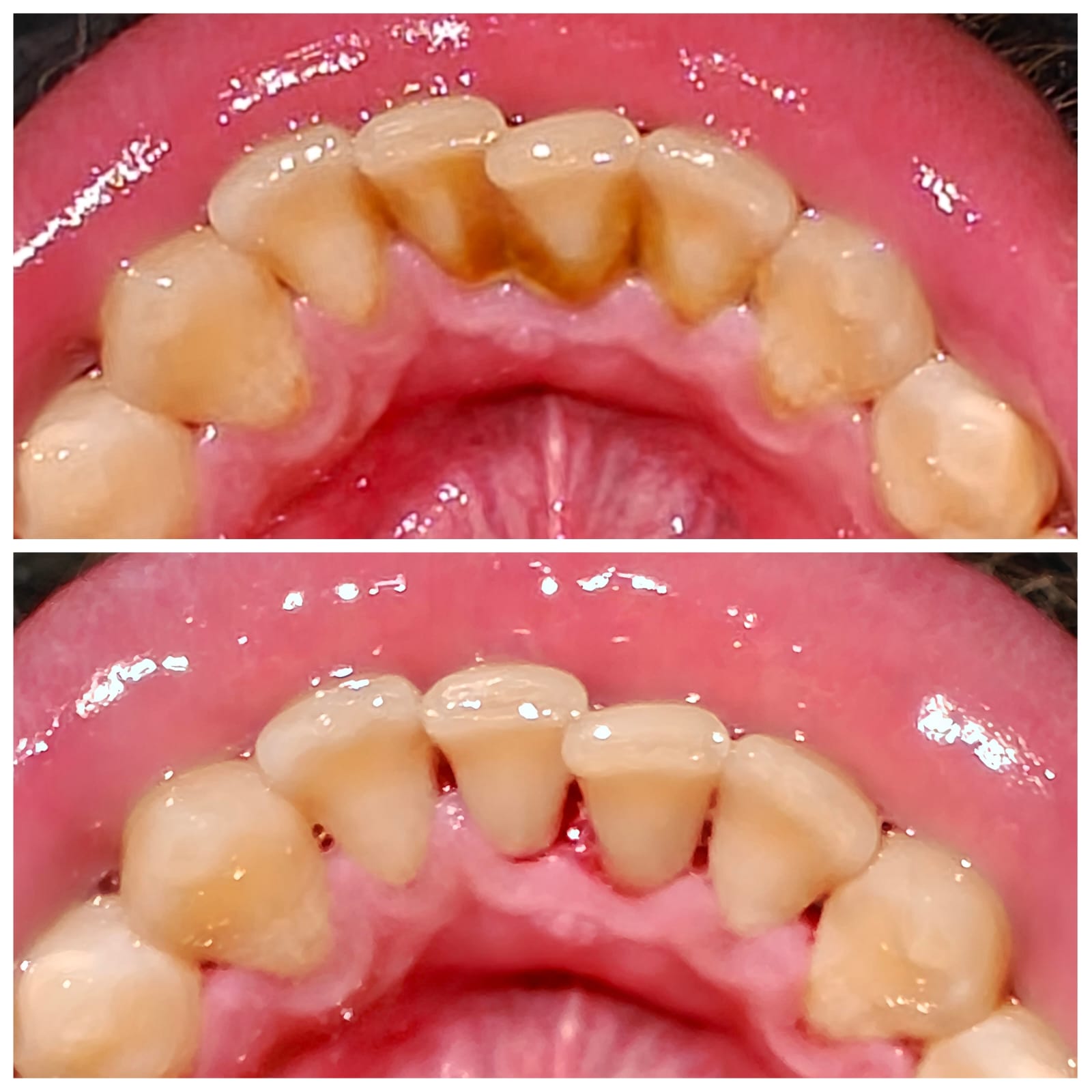 Periodontics Treatments Slide