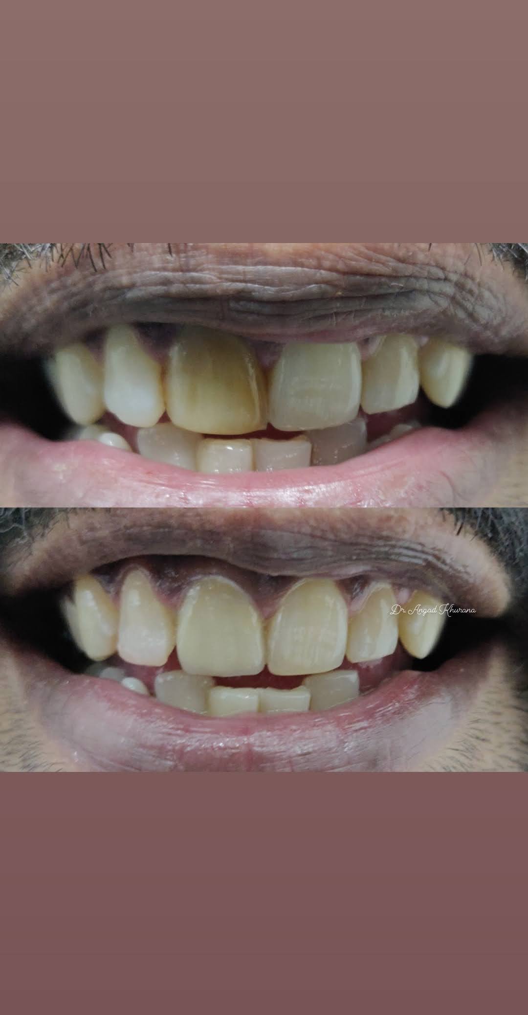 Zenith Dental Care - Zenith Dental Care