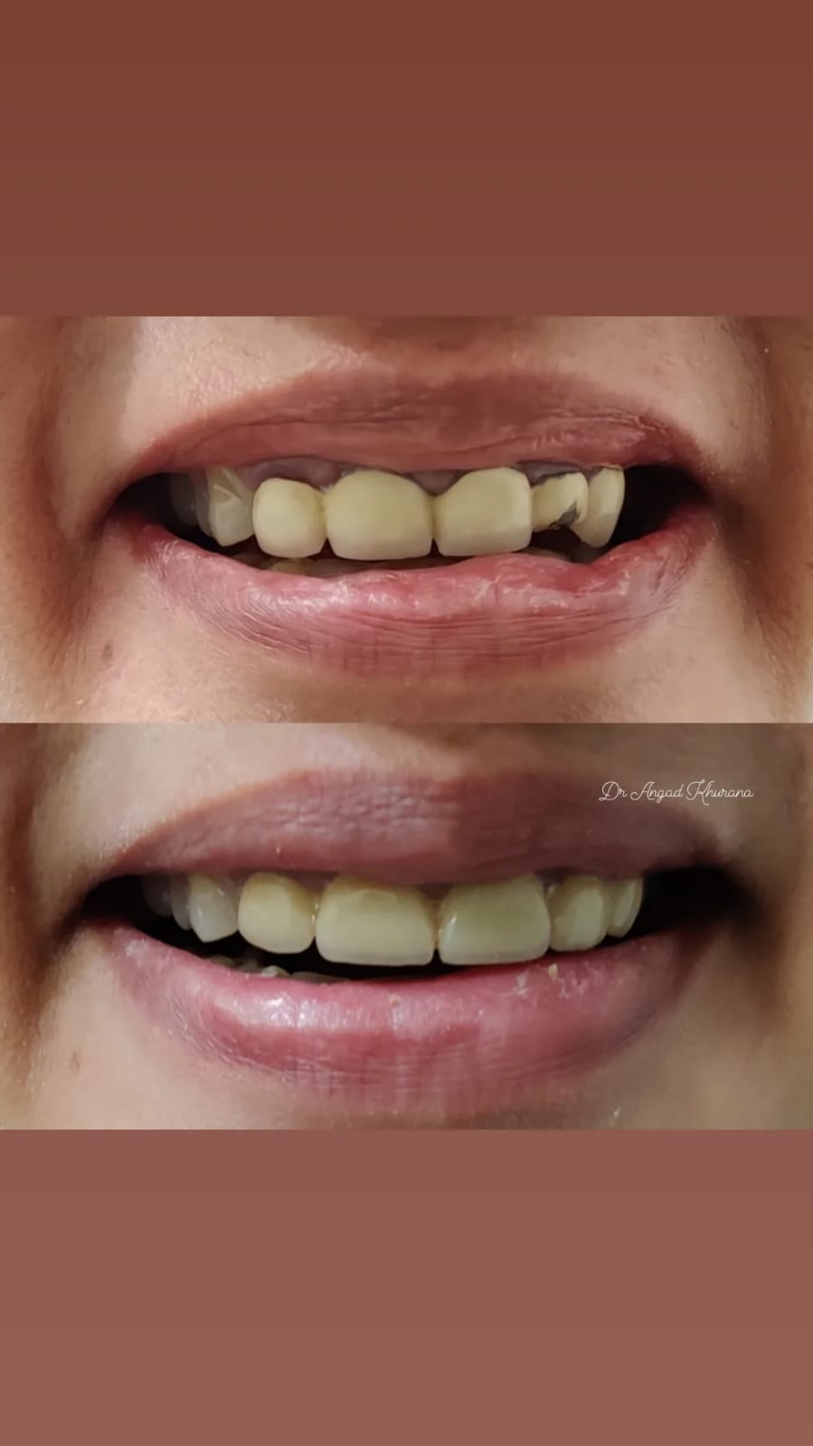 Zenith Dental Care - Zenith Dental Care