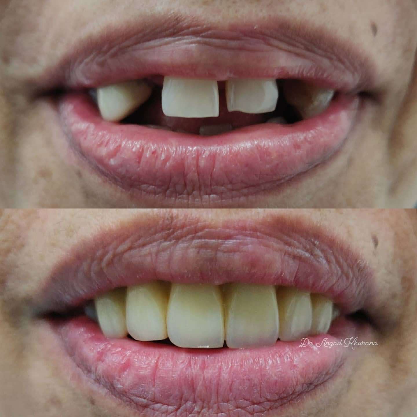 Zenith Dental Care - Zenith Dental Care