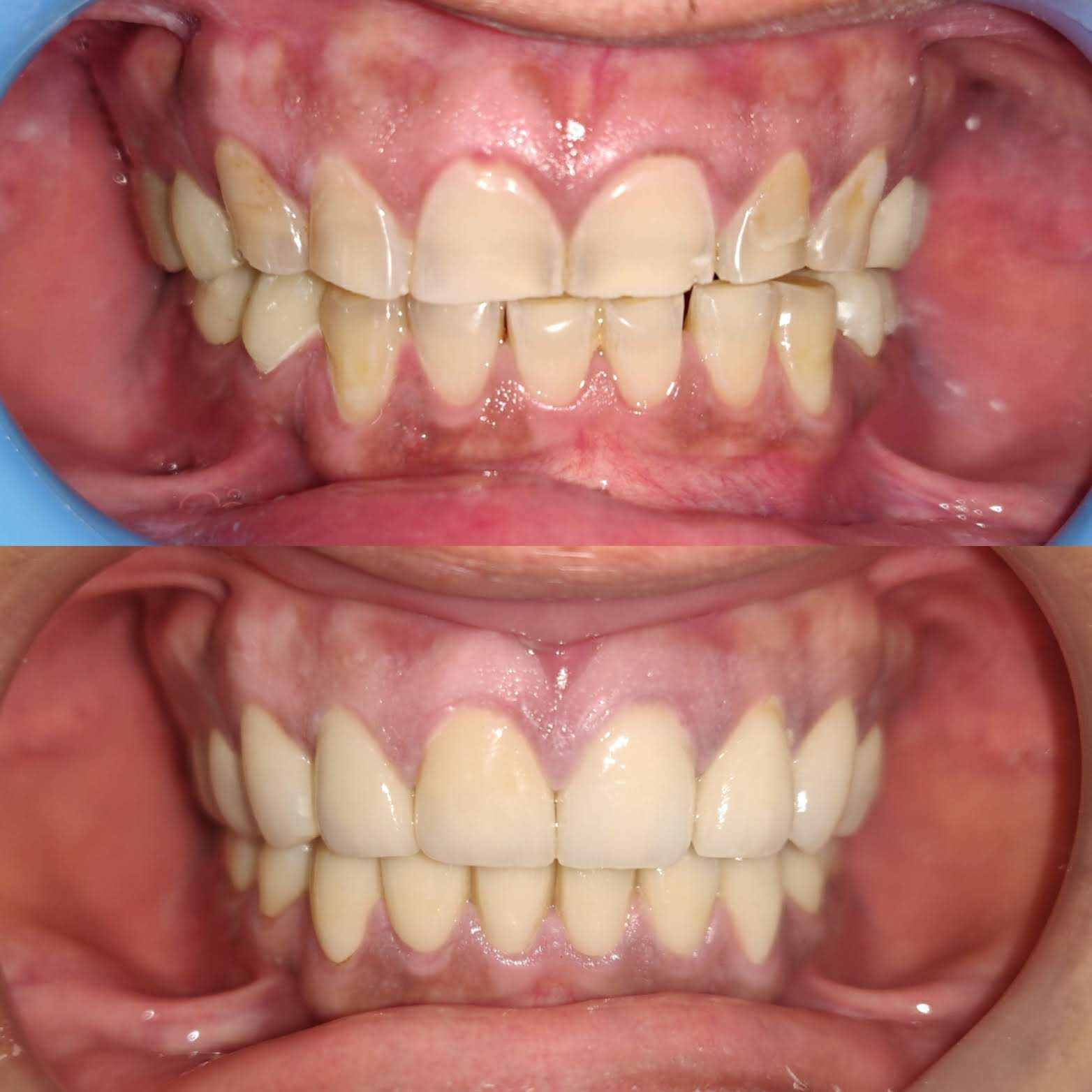 Zenith Dental Care - Zenith Dental Care