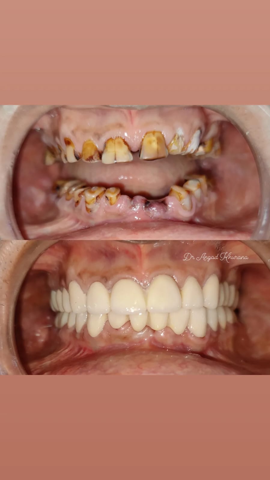 Zenith Dental Care - Zenith Dental Care