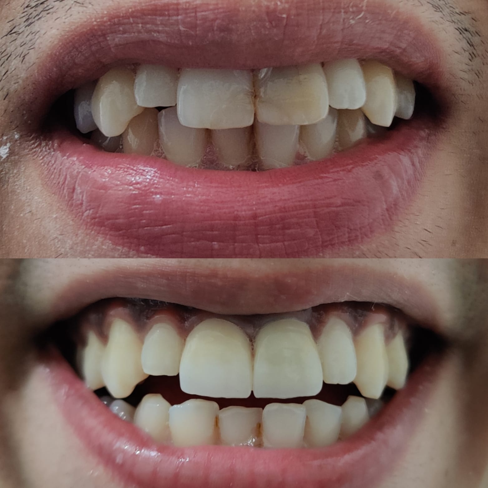 Zenith Dental Care - Zenith Dental Care