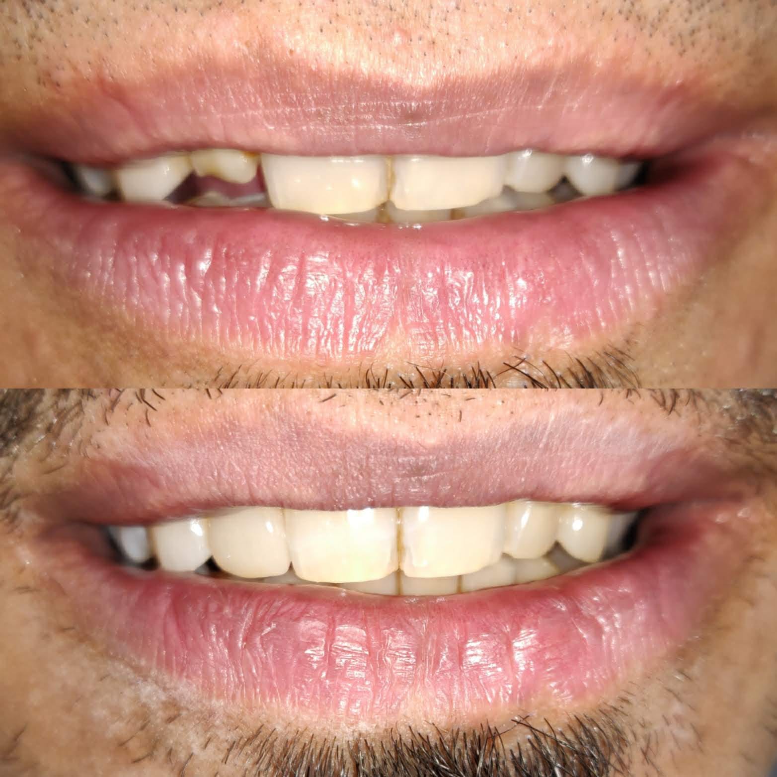 Zenith Dental Care - Zenith Dental Care