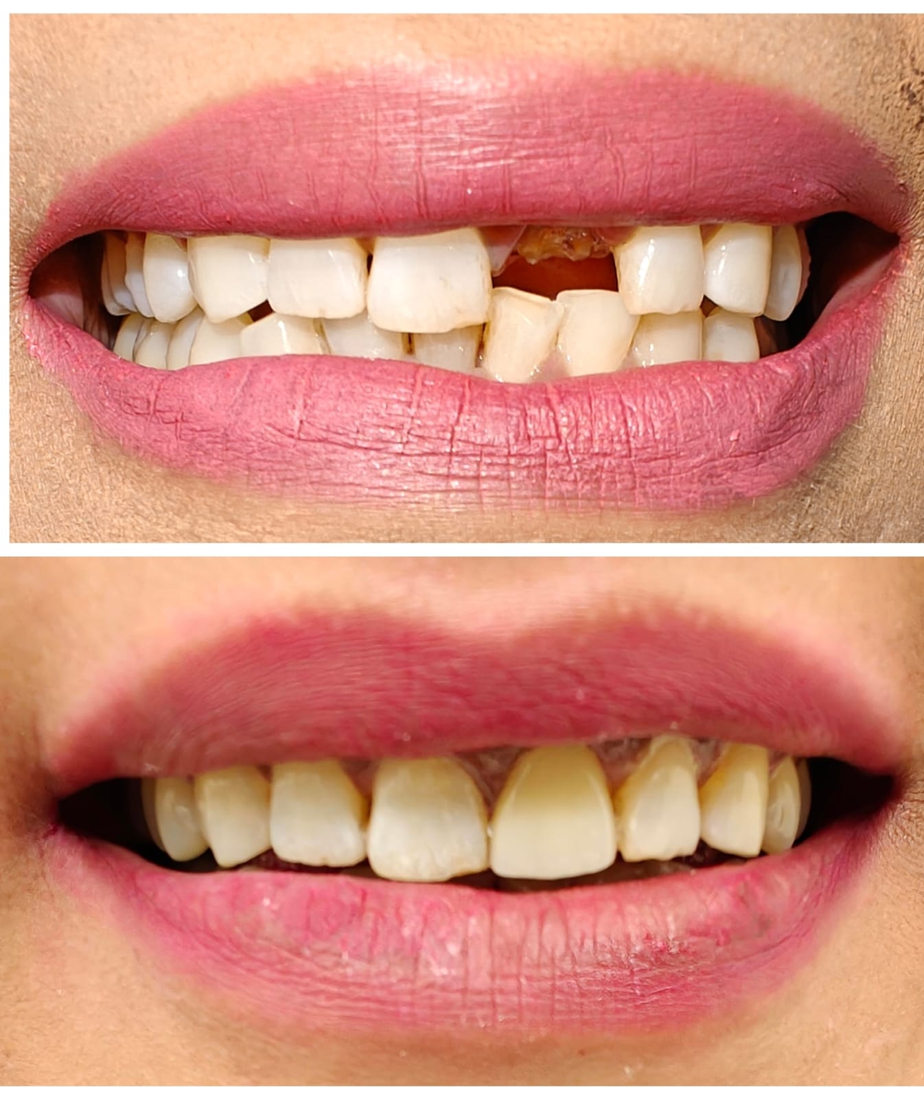 Zenith Dental Care - Zenith Dental Care