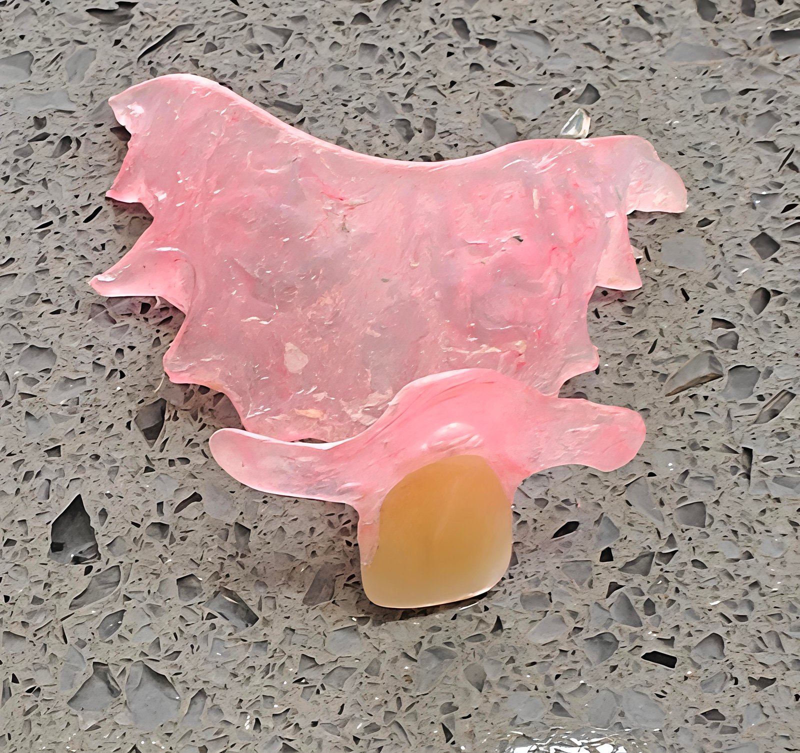 Flexible Partial Denture  - Zenith Dental Care