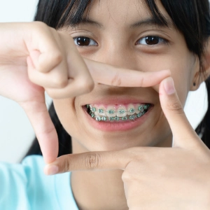 Girl Smile After Dental Braces Treatment