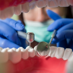 Dentist Checking Teeth, Regular Dental Checkup