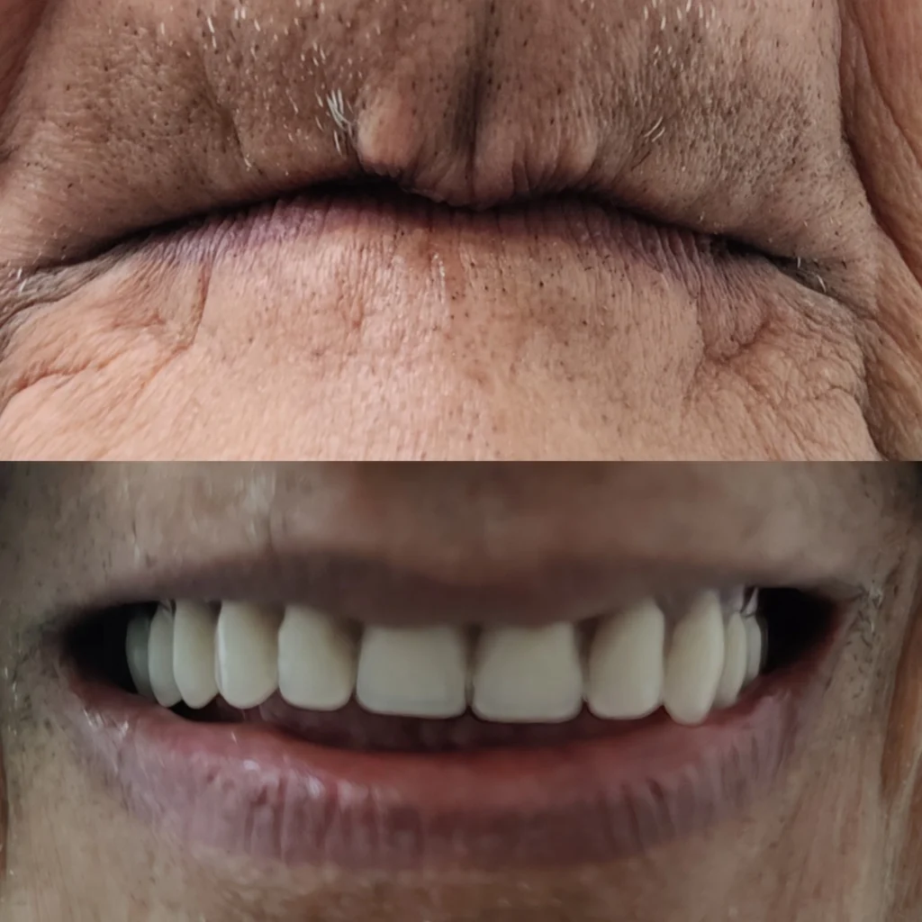 Before and after dental treatment.